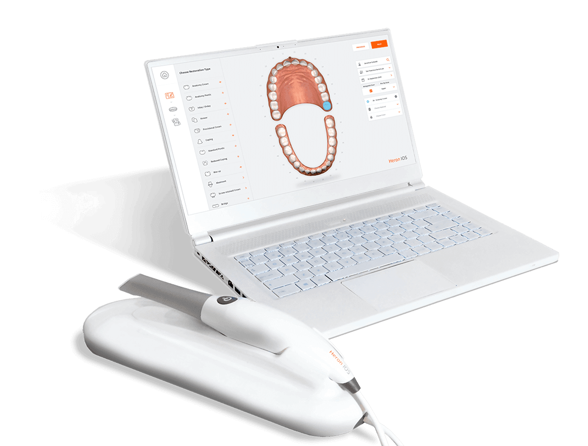 skaner stomatologiczny 3d